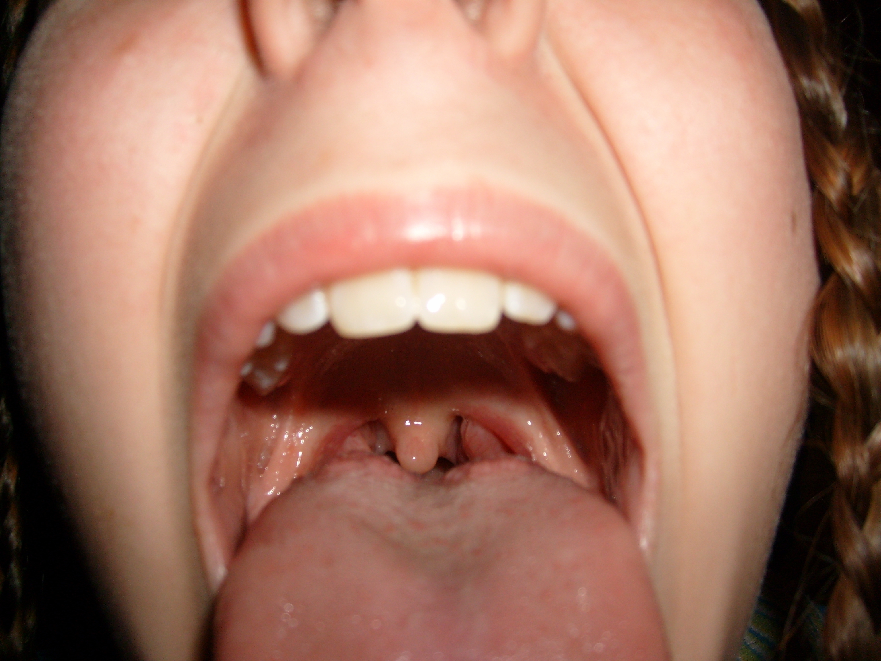 mouth302.jpg